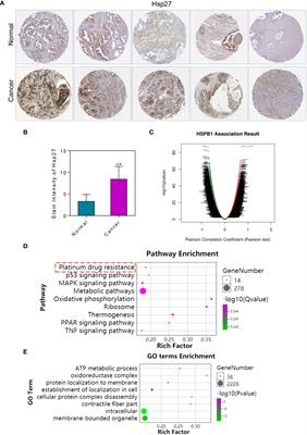 Atractylenolide I inhibits EMT and enhances the antitumor effect of cabozantinib in prostate cancer via targeting Hsp27